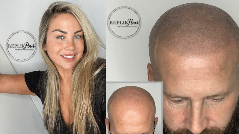 Replik Hair – Pioneering Scalp Micropigmentation Specialists in the UK Market Experience Remarkable Growth and Innovation